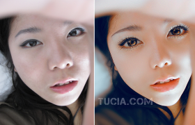 Jak dbać o skórę przy łuszczycy?