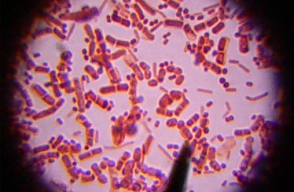 Escherichia coli – uchroń się przed niewidzialnym zagrożeniem